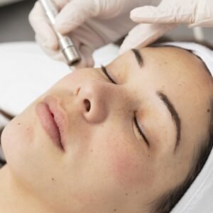 Dermabrasion