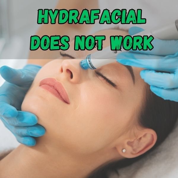 Hydrafacial is hype