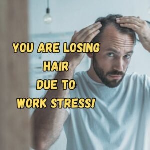 Office Stress and Hair Fall