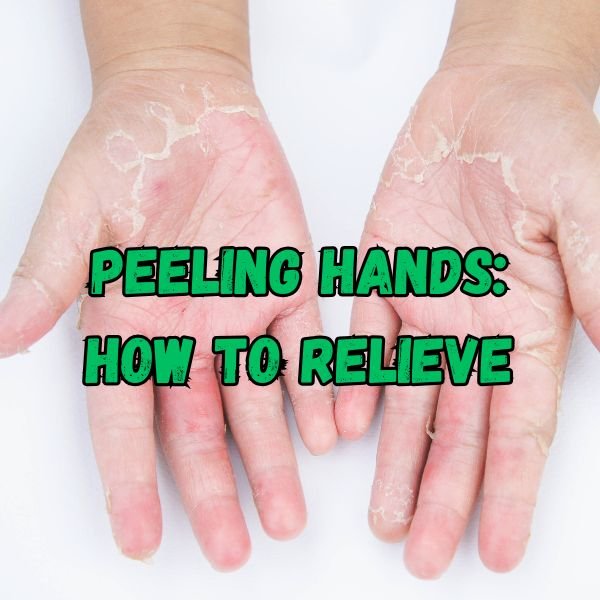Peeling Hands