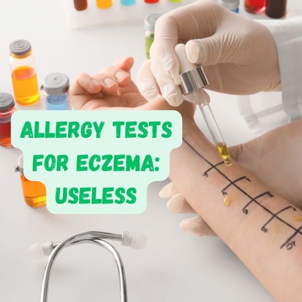 Eczema and Allergy Tests What You Need to Know