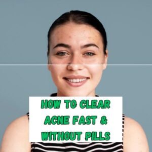 Procedures to clear acne fast