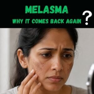 Melasma why it returns again