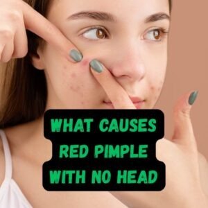 Red pimple with no head